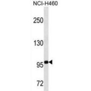abx025001