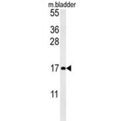 Macrophage Inflammatory Protein 1 Beta (MIP1b) Antibody
