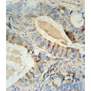 abx025006