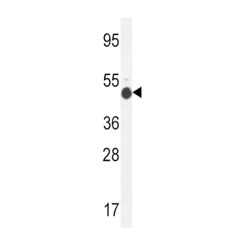 N-Acetyllactosaminide Beta-1,6-N-Acetylglucosaminyl-Transferase (GCNT2) Antibody