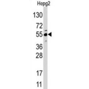 Jumonji Domain-Containing Protein 4 (JMJD4) Antibody