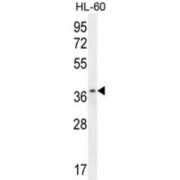 Zinc Finger Protein 322B (ZNF322B) Antibody