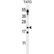 CT45A Antibody