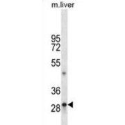 abx025019
