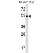 abx025020