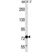 abx025022