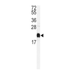 Calmodulin (CaM) Antibody