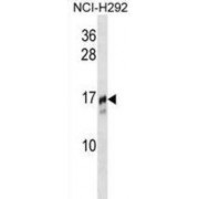 Trafficking Protein Particle Complex Subunit 2 (TRAPPC2) Antibody