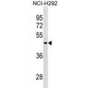 RNA Binding Motif Protein, Y-Linked, Family 1, Member A1 (RBMY1A1) Antibody