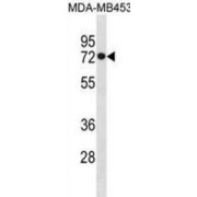 Heat Shock 70 kDa Protein 1-Like (HSPA1L) Antibody