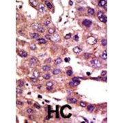 abx025052
