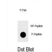 Ammonium Transporter Phospho-Thr465 Antibody