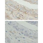 abx025067