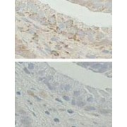 Amyloid B-Peptide-Binding Alcohol Dehydrogenase (ABAD) Antibody