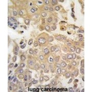 Mitogen-Activated Protein Kinase 4 / ERK4 (MAPK4) Antibody