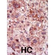 Cyclin G Associated Kinase (GAK) Antibody