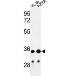 Immunoglobulin Heavy Constant Alpha 1 (IGHA1) Antibody