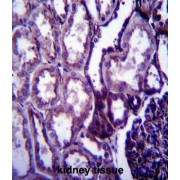 Insulin-Like Growth Factor I (IGF1) Antibody