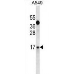 Insulin-Like Growth Factor I (IGF1) Antibody