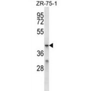 Major Facilitator Superfamily Domain-Containing Protein 2B (MFSD2B) Antibody