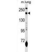 Macrophage Mannose Receptor 1 (MRC1L1) Antibody