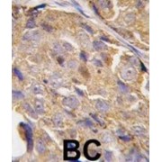 Eukaryotic Translation Initiation Factor 4B (EIF4B) Antibody