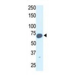 E3 Ubiquitin-Protein Ligase Synoviolin (SYVN1) Antibody