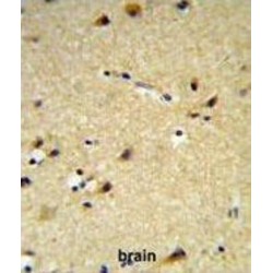 Cytochrome P450 26A1 (CYP26A1) Antibody