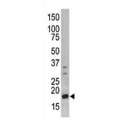 Western blot analysis of H3 (pS10) antibody in CEM cell line lysate (35 ug/lane). H3 (pS10) (arrow) was detected using the purified polyclonal antibody.