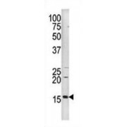 Western blot analysis of H3 (pS10) antibody in HepG2 cell line lysate (35 ug/lane). H3 (pS10) (arrow) was detected using the purified polyclonal antibody.