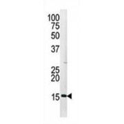 Western blot analysis of H3 (pS28) antibody in HepG2 cell line lysate (35 ug/lane). Mouse H3 (pS28) (arrow) was detected using the purified polyclonal antibody.