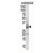 Down Syndrome Critical Region Protein 1 (DSCR1) Antibody