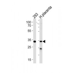 STIP1 Homology And U-Box Containing Protein 1 (STUB1) Antibody
