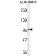 Bromodomain Testis-Specific Protein (BRDT) Antibody