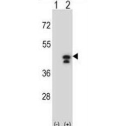 Phosphoglycerate Kinase 1 (PGK1) Antibody