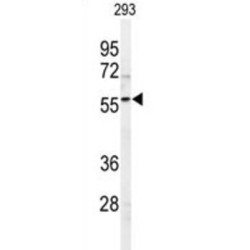 Sphingosine Kinase 1 (SPHK1) Antibody