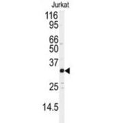 Transcription Factor JunD (JUND) Antibody