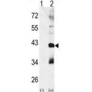 abx025127