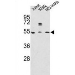 Apolipoprotein A4 (APOA4) Antibody