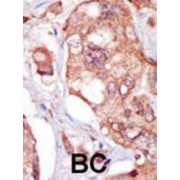 abx025131