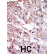 Serine/Threonine-Protein Kinase MARK2 (MARK2) Antibody