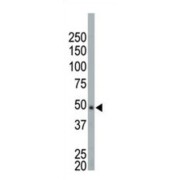 abx025140