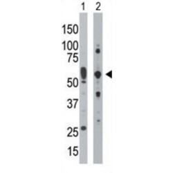 Interferon-Induced Double Stranded RNA-Activated Protein Kinase (EIF2AK2) Antibody
