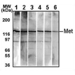 Hepatocyte Growth Factor Receptor / HGFR (MET) Antibody