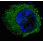 Hepatocyte Growth Factor Receptor / HGFR (MET) Antibody