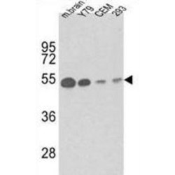 Tubulin Beta-1 Chain (TBB1) Antibody