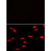 PR/SET Domain-Containing Protein 07 (SET07) Antibody