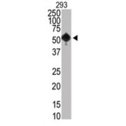 abx025169