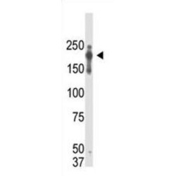 PR Domain Zinc Finger Protein 2 (PRDM2) Antibody