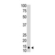 Small Ubiquitin Related Modifier Protein 1 (SUMO1) Antibody